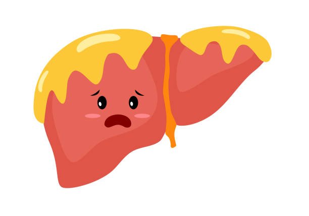 Non-Alcoholic Fatty Liver Disease (NAFLD) Causes & Diet Reversal
